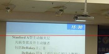 投影仪怎么使用?win7系统使用投影仪的操作方法