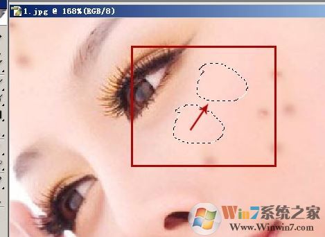 照片的脸上长痘痘怎么调？教你照片脸上长痘痘怎么去除